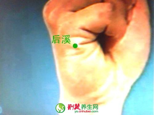 艾灸美容 艾灸後溪穴治麥粒腫