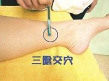 三陰交穴拔罐可補精血 五種拔罐法的具體操作