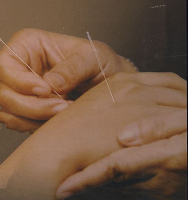 針灸對五臟六腑的好處 陰陽平衡