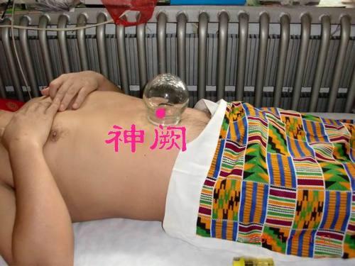 艾灸穴位圖 祛病延年的6大穴位