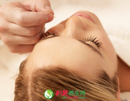 針灸是調理亞健康的理想方法