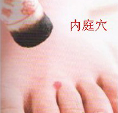 上火體質多按四大清火穴位 降火去燥